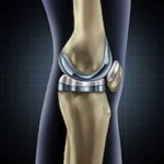 Knee Knee