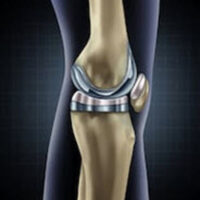 Knee Knee
